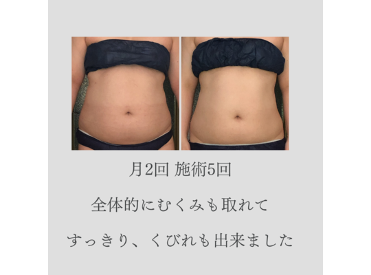 センター北マッサージ