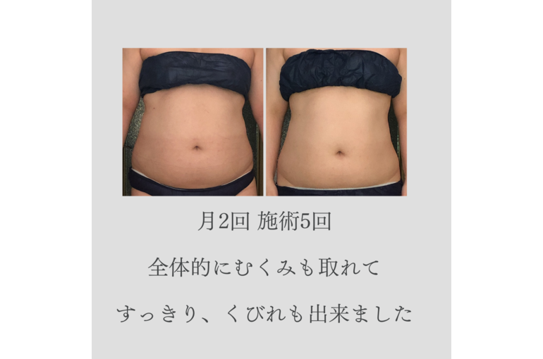 センター北マッサージ